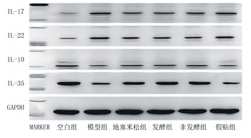空白組和支氣管哮喘各組大鼠肺組織中IL－17、IL－22、IL－10、IL－35蛋白表達(dá)電泳圖